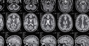 AI vs VMA: Exploring areas where artificial intelligence outperforms virtual medical assistants in healthcare